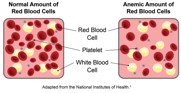 What is Anemia? – Ferralet® 90